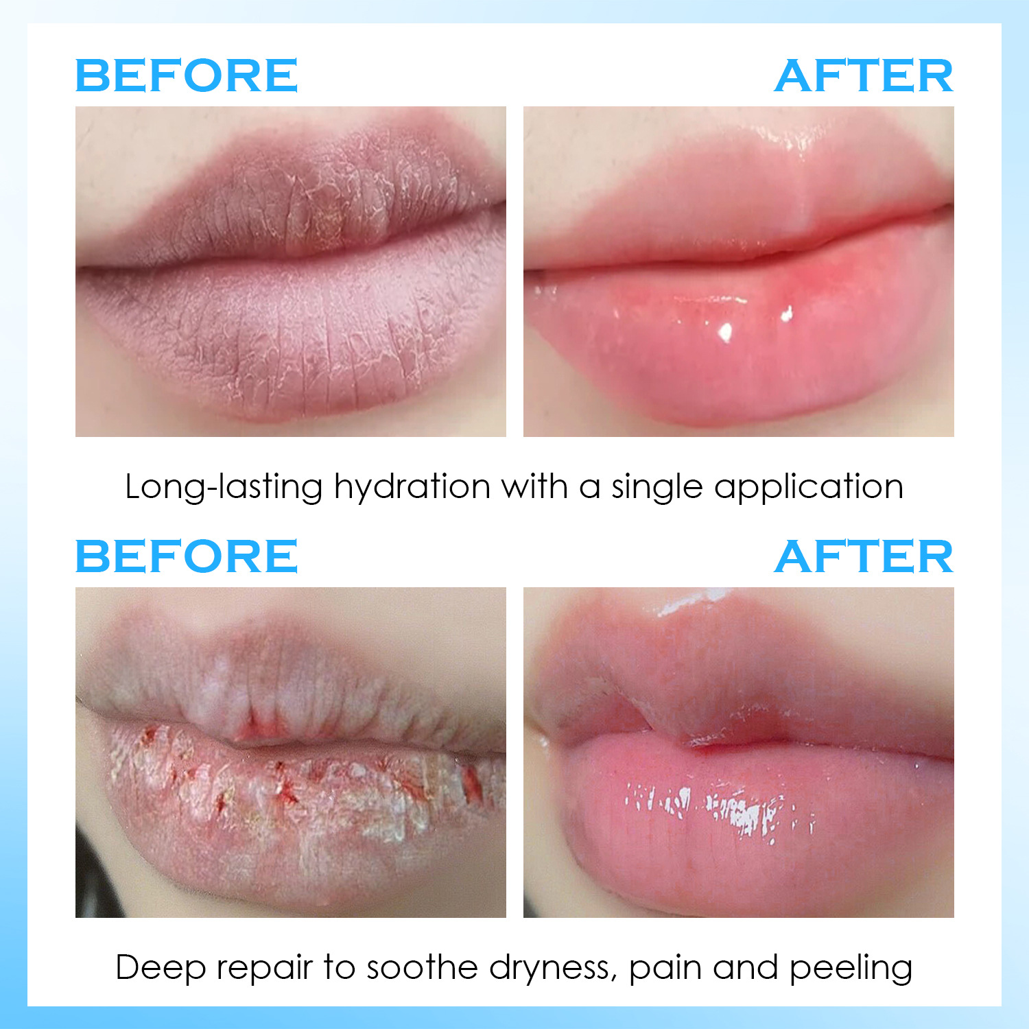 Lip Serum Moisturizing Balm Hy - Lip Balm 评论和价格